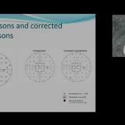 Glaucoma Detection Lecture Series Part 5 Analysis Of Visual Field Printouts Seven In One