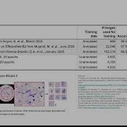 CSCI E104 Neural Network For Malaria Detection