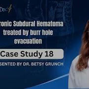 Case Study 18 Chronic Subdural Hematoma Treated By Burr Hole Evacuation Presented By Dr Grunch