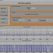Encryption And Decryption Of ECG Signal Matlab Project Source Code
