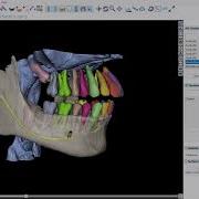 BSP V4 13 Completely Automatic AI Segmentation Of Teeth Airways Jaws And Nerves Free