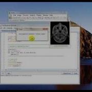 ImageJ Lesson 2 3DFlight