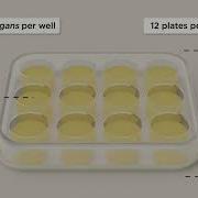 WormBot A High Throughput System For Studying Aging In C Elegans