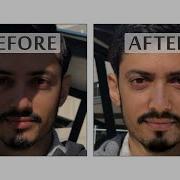 This AI Removes Shadows From Your Photos
