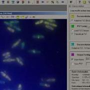 AutoQuant 3D Deconvolution