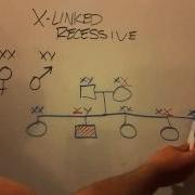X Linked Recessive Inheritance