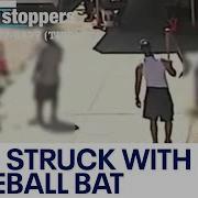 NYC Crime Man Struck With Baseball Bat In Unprovoked Attack