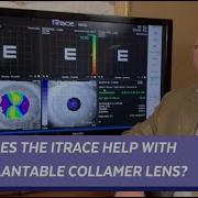 ITrace U Using The ITrace For ICLs