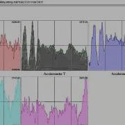 Shimmer Accelerometer And ECG Streaming Using SensorMonkey