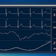 Shimmer3 ECG Demo