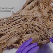 Brachial Plexus And Axillary Artery