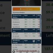 WEBCEPH PREMIUM PA Cephalometric Analysis
