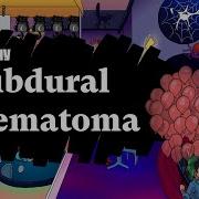 Subdural Hematoma SAH Part 1 Sketchy Medical USMLE Step 1