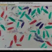ImageView Microscope Camera Software Reports