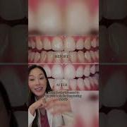 What Whitening Products Work For Different Stains On Teeth Teethwhitening Dentist Whiteteeth