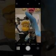 Occlusal Analysis 1