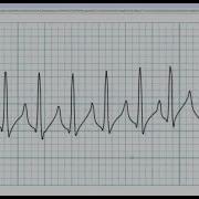 Chidi Rosenthal Code Blue Simulation