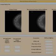 MATLAB Code Of Medical Image Compression Using DWT With And Without Huffman Encoding