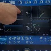 Ventilator Waveforms