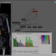 Multi Modal Visibility Driven Transfer Function And Automation For PET CT Visualzation