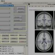 SPM Parameter Extraction With Marsbar