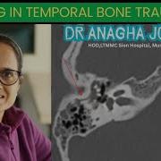 Dr Anagha Joshi Fractures Of The Temporal Bone HRCT Temporal Bone