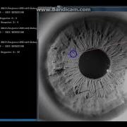 Iris Detection OpenCV