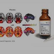 This Is Your Brain On Acid Seriously