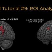 SPM Tutorial 9 ROI Analysis