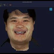 RAYFace Scan Data Alignment