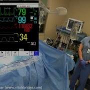 Using The VitalsBridge With Standardized Patients In High Fidelity Simulations