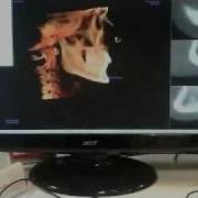 Anatomage 3D Cephalometric Analysis Mp4