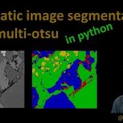 115 Auto Segmentation Using Multi Otsu