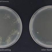 Bacteria Before And After Washing Hands