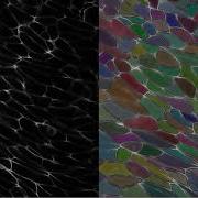 Cell Segmentation And Tracking