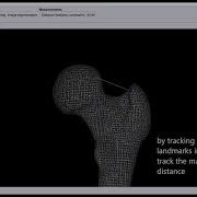 Shape Analysis And Automated Measurements