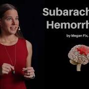 Subarachnoid Hemorrhage And Thunderclap Headaches The Heart Course