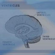 Choroid Plexus Papillomas Brain Tumor