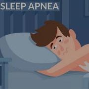 Sleep Apnea Causes Signs And Symptoms DIagnosis And Treatment