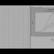 Computing Normal Probabilties With Excel And Matlab