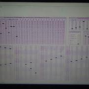 OMR Detection Using Python OpenCV Using Digital Image Processing Without Template Matching
