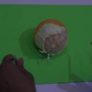 Dissection Techniques In Surgery 2