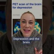 Can You See Depression In The Brain