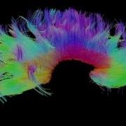 Peering Inside A Human Brain Map