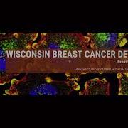 Data Science Project Introduction Breast Cancer Detection Using SVM And KNN