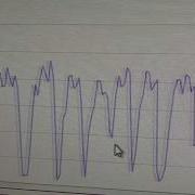 Trying Out A Pure Javascript WebSerial Plotter In Chrome