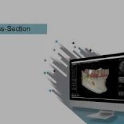 CS 3D Imaging Generate A Cross Section Report