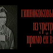 САМЫЕ НЕИЗВЕСТНЫЕ И ЖУТКИЕ ЭКСПЕРИМЕНТЫ