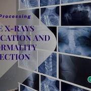 Matlab Image Processing Projects Bone X Rays Classification Detection ClickMyProject