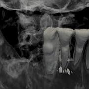 In Depth Dental Volume And ISO Surface Visualisation Of The Visible Human Dataset